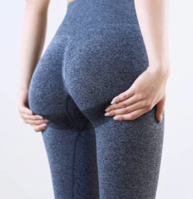 Before & after results of awake liposuction, lipo-sculpting and fat transfer to buttocks, Brazilian Butt Lift, BBL performed by top Liposuction Surgeon, Central NJ