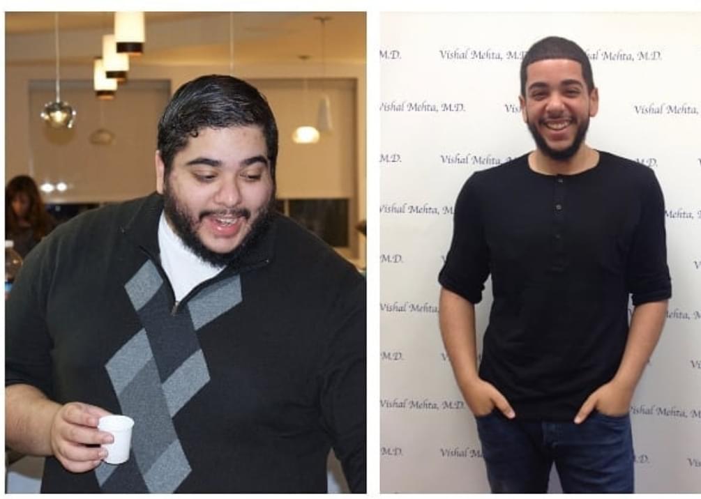Mehta Bariatric Center